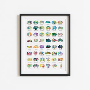 May include: A framed print of a colourful watercolour illustration of the human brain. The brain is divided into sections, each with a different colour and pattern. The print includes the names of each brain region.