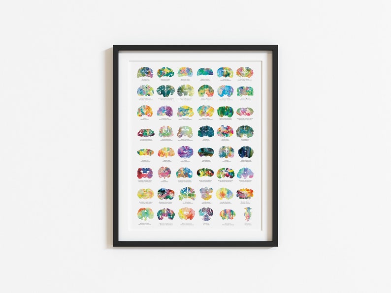 May include: A framed print of a colourful watercolour illustration of the human brain. The brain is divided into sections, each with a different colour and pattern. The print includes the names of each brain region.