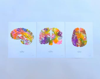 Impresiones en risografía sobre neurociencias / Juego de impresiones sobre el cerebro / Arte mural sobre neurociencias / Anatomía del cerebro / Regalo para estudiantes de medicina, enfermeras y médicos