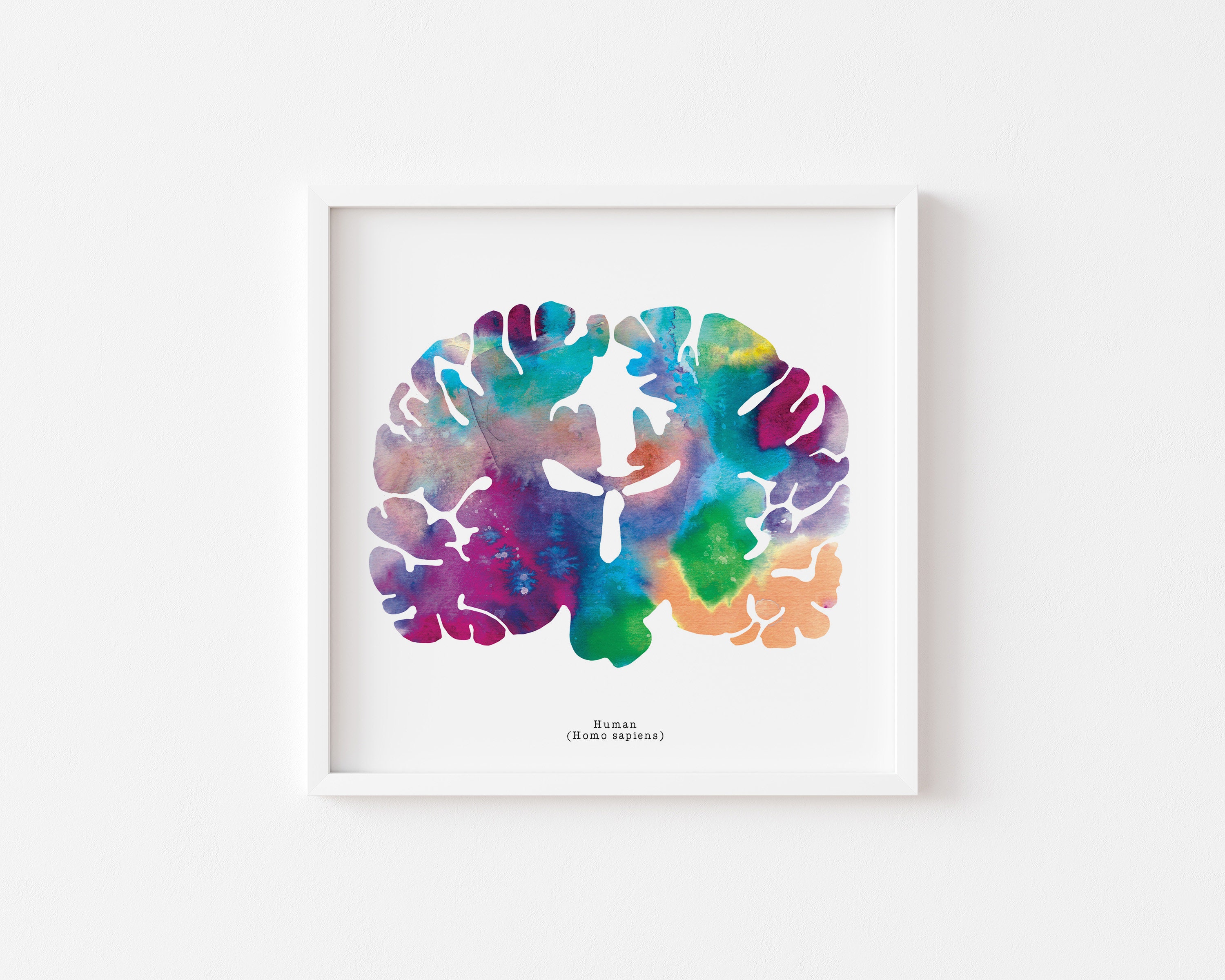 Coronal Human Brain Art Print Set - Three 8.5" X 8.5" Watercolor Prints ...