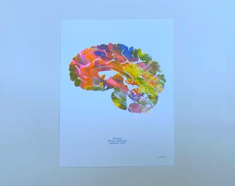 Impresión risográfica / Impresión artística colorida del cerebro / Arte mural de neurociencia / Anatomía del cerebro / Regalo para estudiantes de medicina, médicos, enfermeras / Sagital