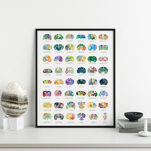 Cartel de anatomía cerebral - Cartel veterinario de 18 " x 24 " - Veterinarian Tech Gift - Cartel de anatomía de neurociencia - Arte de pared de gran tamaño