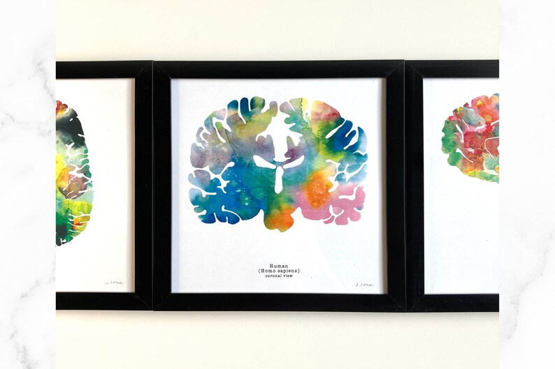 Human Brain Print Set - Three 8.5" X 8.5" Watercolor Prints ...