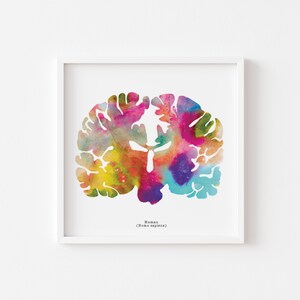 Coronal Human Brain Art Print Set - Three 8.5" X 8.5" Watercolor Prints ...