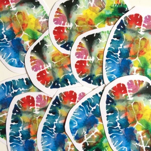May include: A set of colourful watercolour brain illustrations. Each brain is painted in a unique combination of colours, including blue, green, red, yellow, and black. The illustrations are on white paper and have a slightly textured surface.
