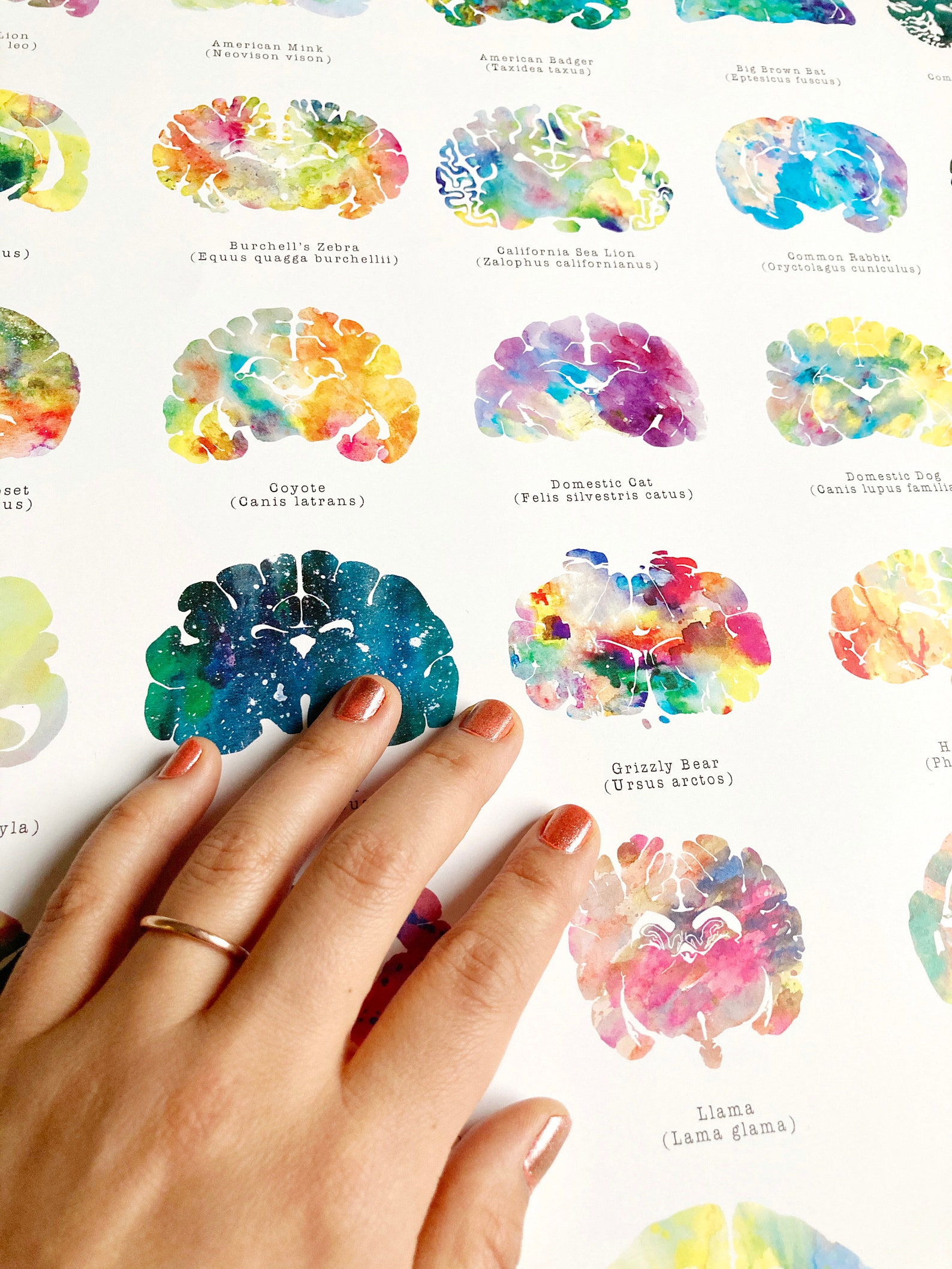Brain Anatomy Poster - 16" X 20" Oversized Wall Art - Great Medical ...