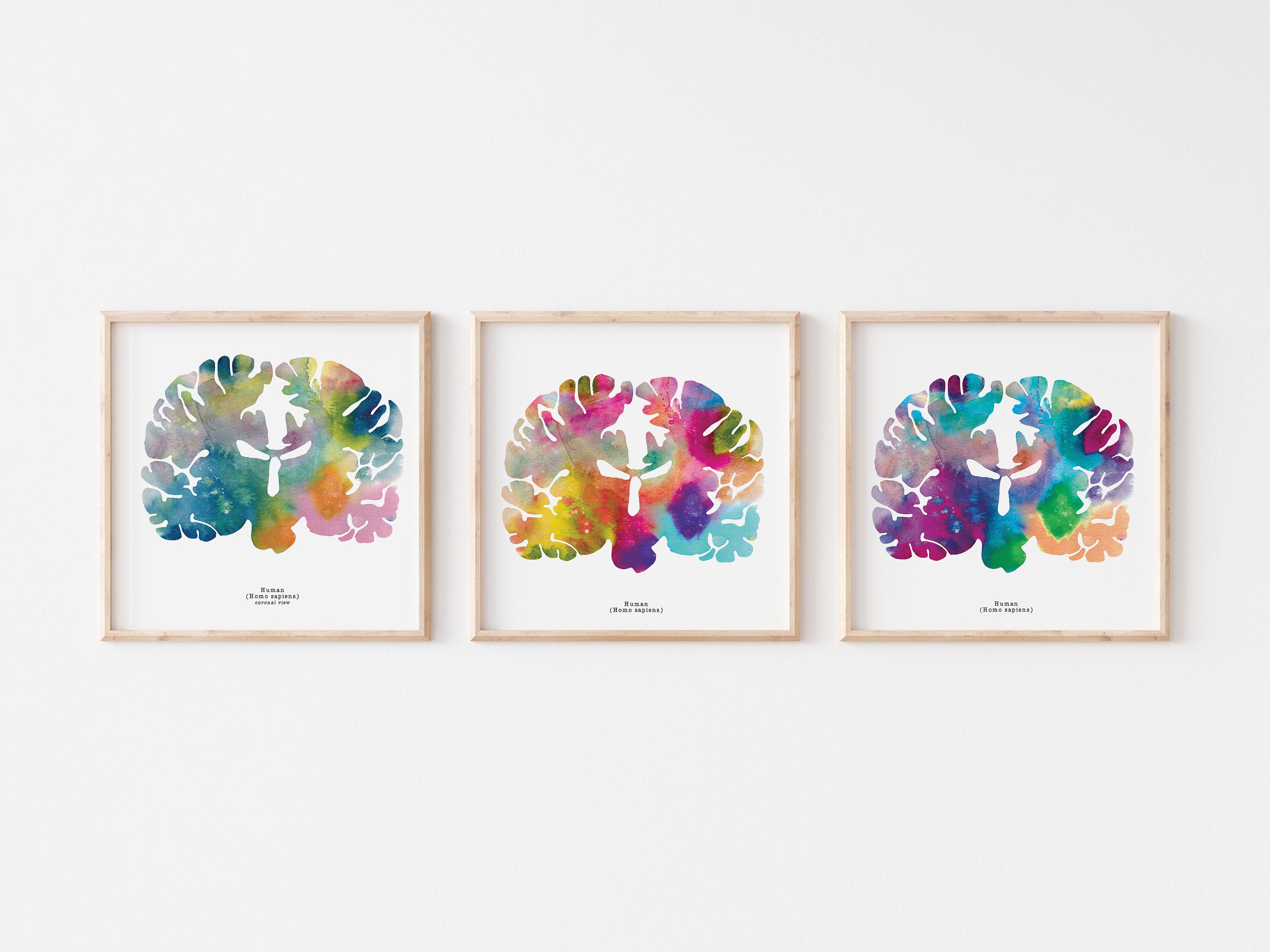 Coronal Human Brain Art Print Set - Three 8.5" X 8.5" Watercolor Prints ...