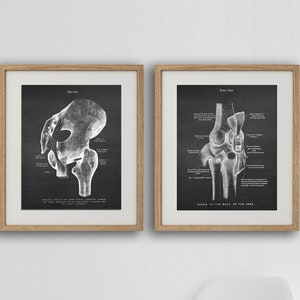 Hip and Knee Joint Human Anatomy Art Prints set of 2 unframed Medical Decor