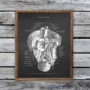 Anatomy of The Duodenum Medical Classroom Clinic Doctor Office Wall Decor Print # 3
