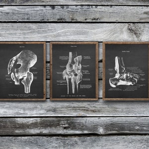 Orthopedic Doctor Decor Anatomy of Human Joints set of 3 Unframed Hip Knee Ankle Joints Art Prints
