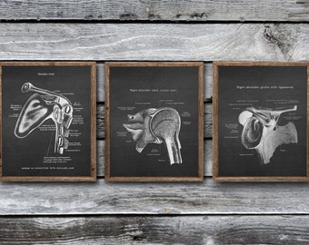 Orthopedic Doctor Decor set of 3 Unframed Shoulder Joints Anatomy Art Prints