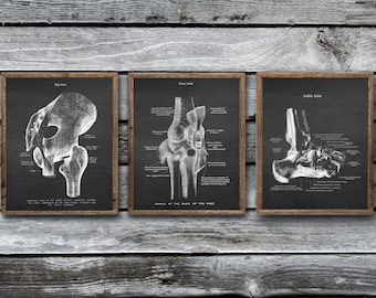 Orthopedic Doctor Decor Anatomy of Human Joints set of 3 Unframed Hip Knee Ankle Joints Art Prints