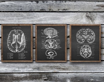 Anatomy of Human Brain set of 3 Unframed Art Prints Neuroscience Decor