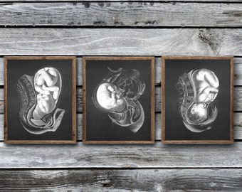 Womb Anatomy Art Prints, Set of 3, Obstetrics and Gynecology Decor