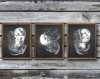 Pregnancy Womb Anatomy Art set of 3 Unframed Decor Art Prints Obstetrics and Gynecology gifts