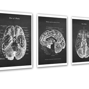 Neuroscience Anatomy of Human Brain Set of 3 Unframed Decor Art Prints ...