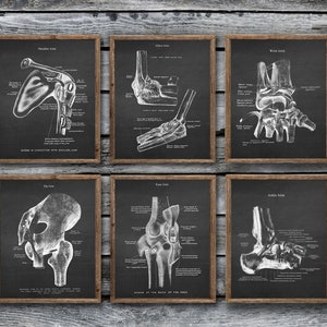 Orthopedic Posters Anatomy of Human Joints set of 6 Unframed Hip Shoulder Knee Joints Decor Gifts