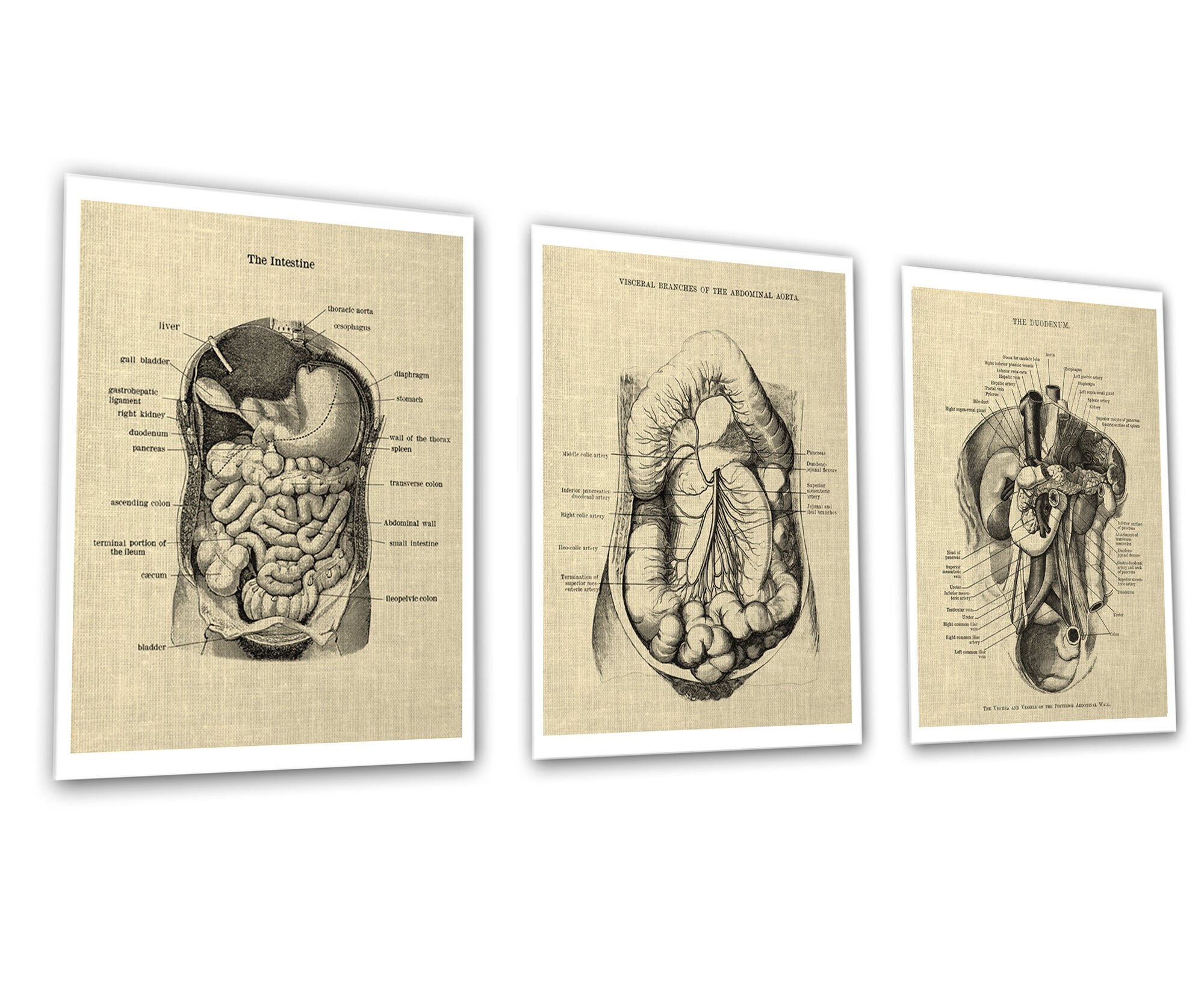 Gastrointestinal Anatomy Set of 3 Unframed Medical Decor Art Prints ...