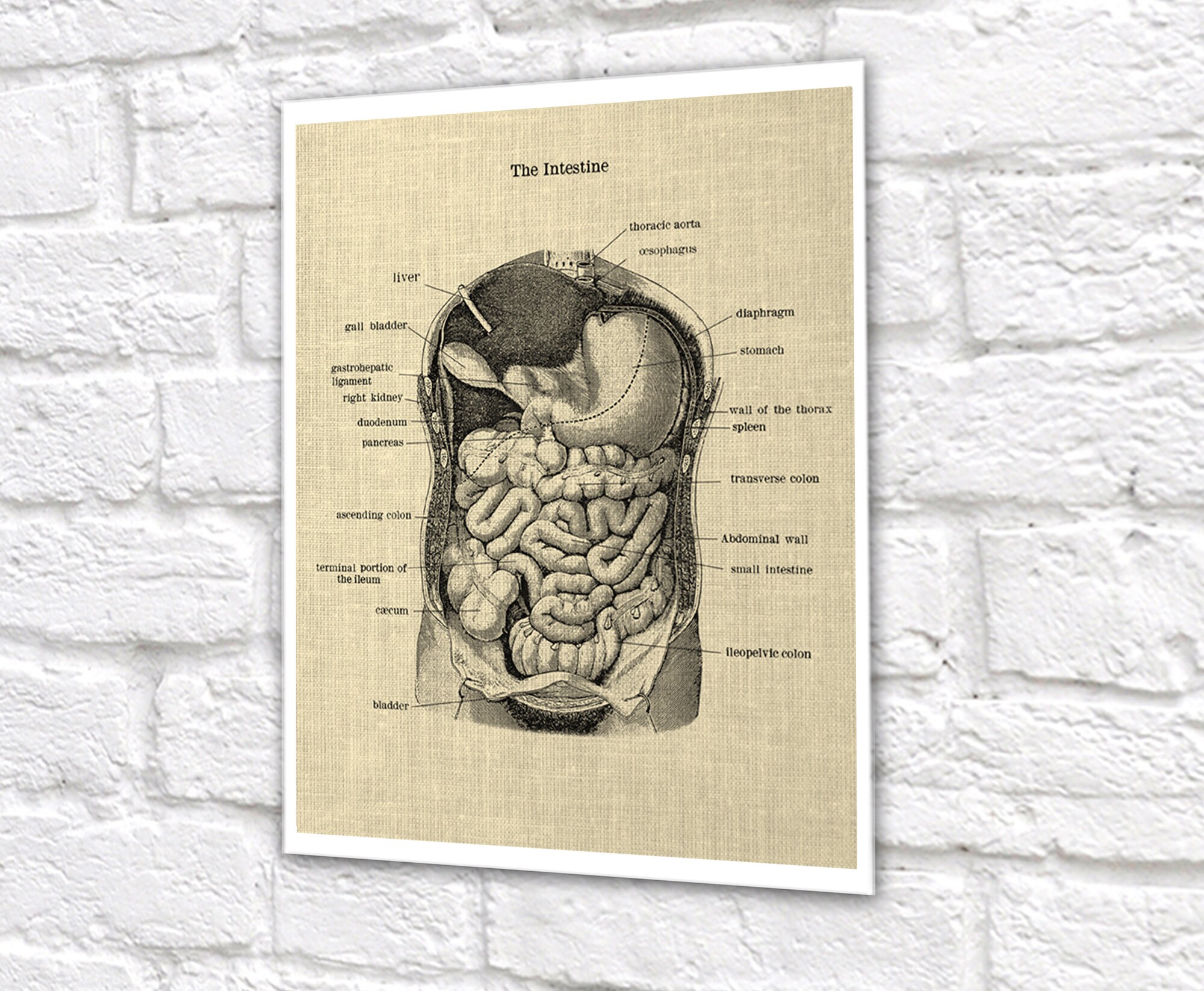 Gastrointestinal Anatomy Set of 3 Unframed Medical Decor Art Prints ...