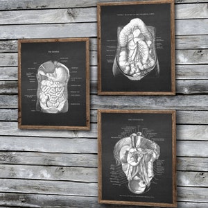 Gastrointestinal Anatomy set of 3 Unframed Medical Decor Art Prints Gift for Gastroenterologist