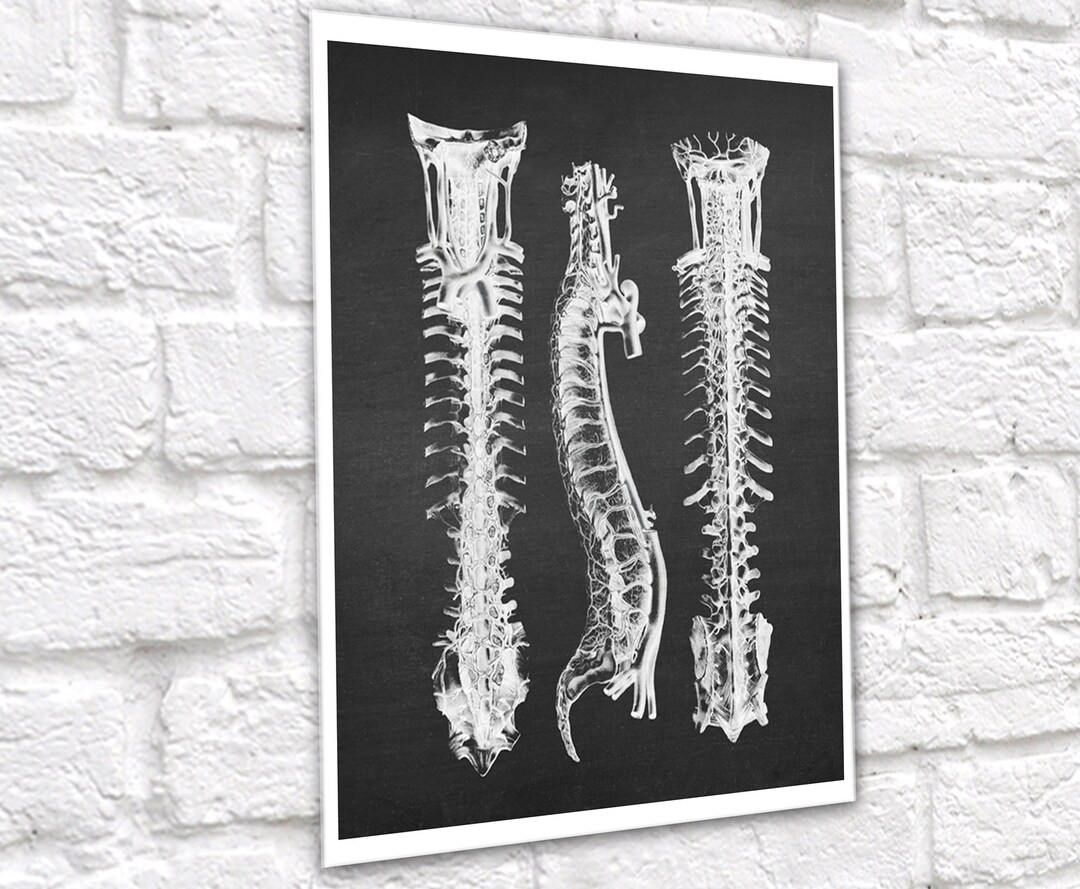 Spine Anatomy Print Wall Decor Chiropractor Gift, Physical Therapist