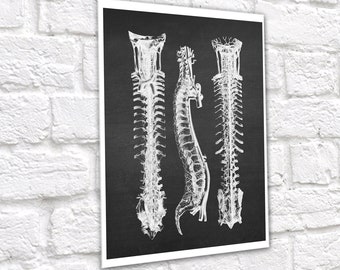 Spine Anatomy Art Print, Chiropractor Physical Therapist Gift