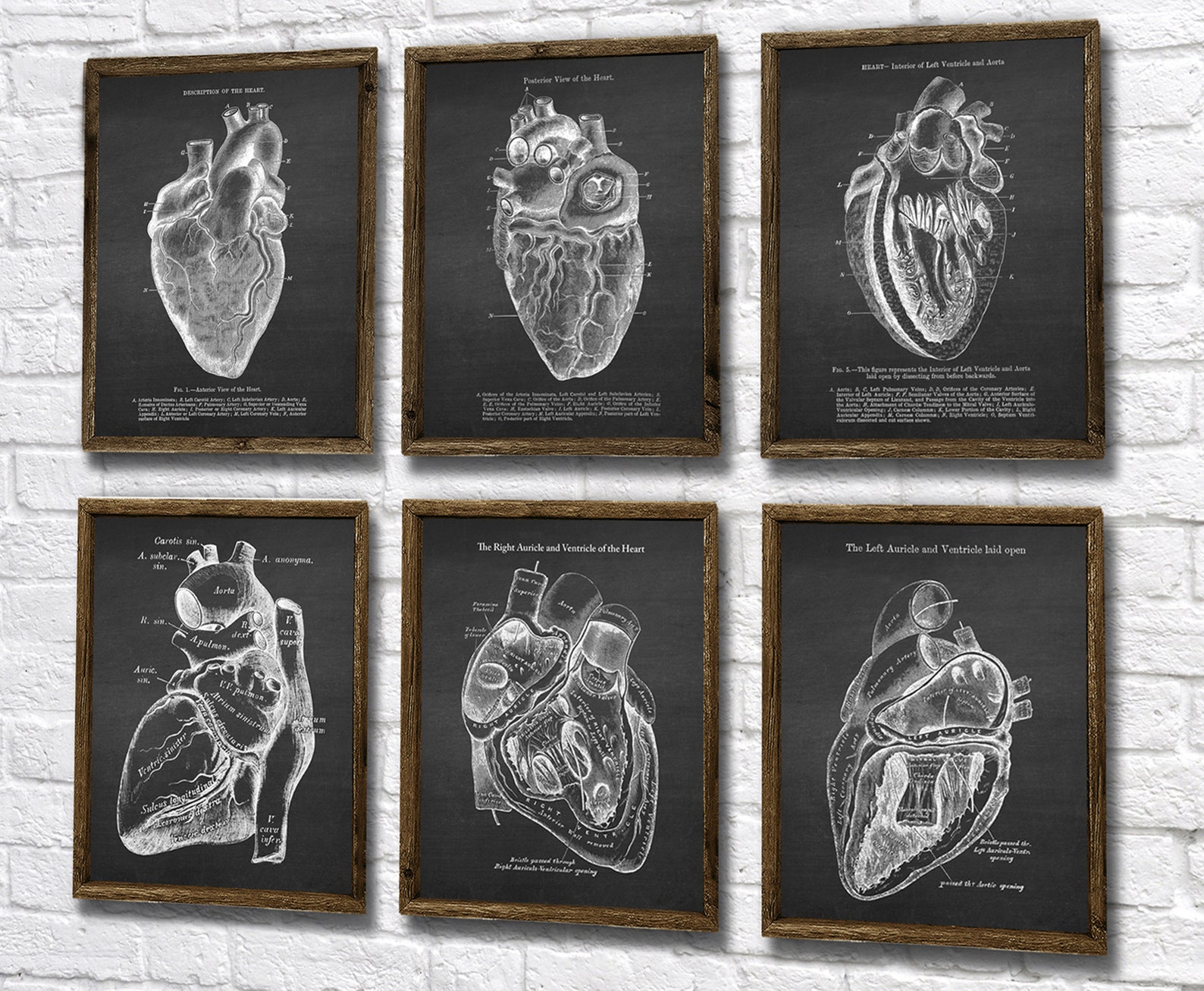 Anatomy of Human Heart Set of 6 Unframed Decor Art Prints Gift for ...