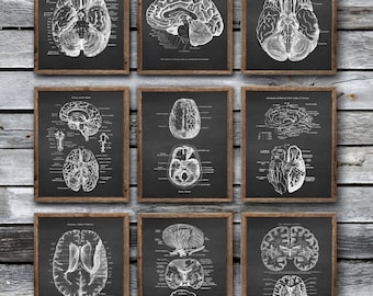 Neurology Vintage Posters Brain Anatomy Print Brain Cross - Etsy