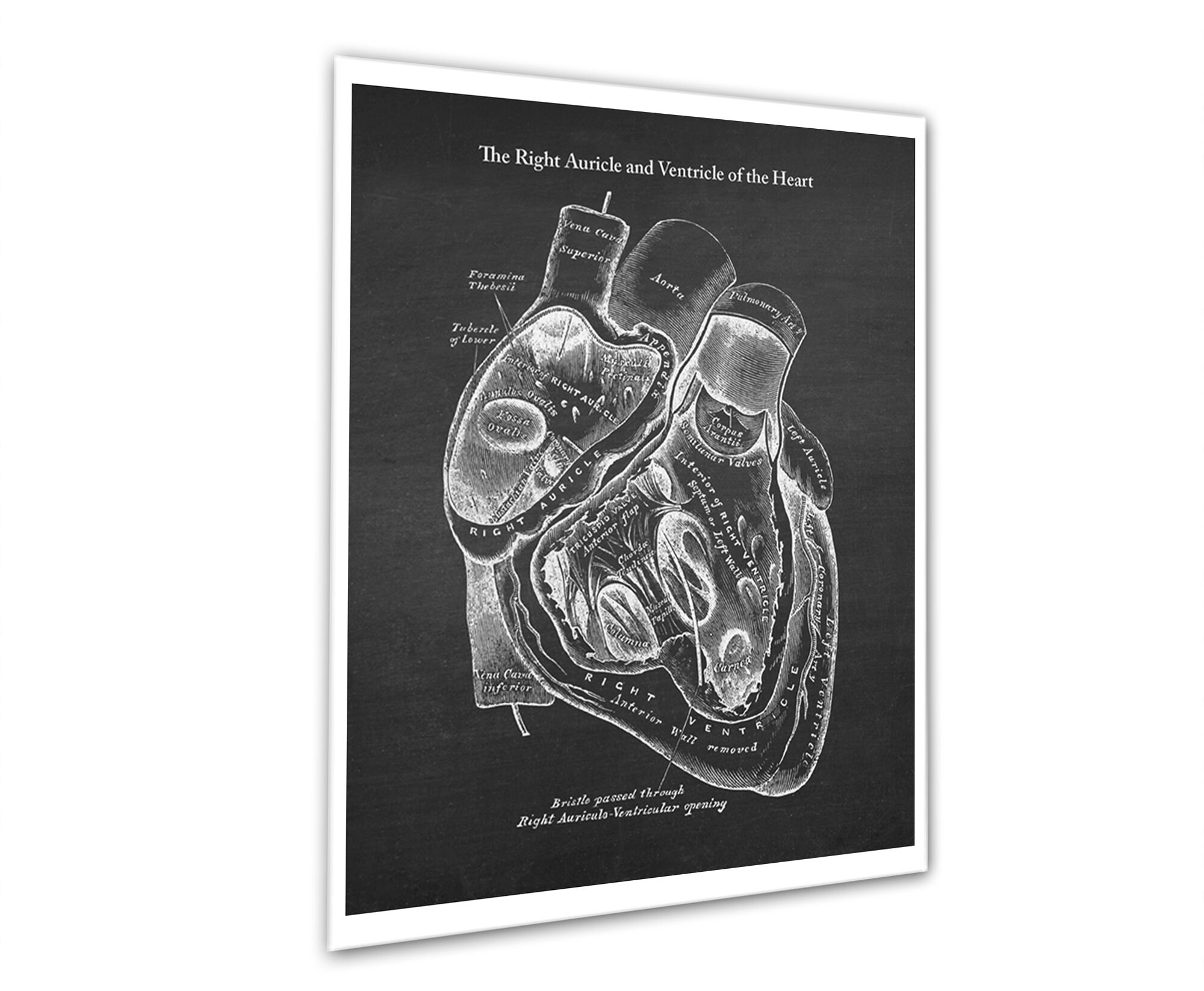 Anatomy Heart Art Prints Set of 3 Unframed Wall Art - Etsy