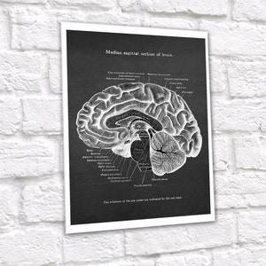 Neuroscience Anatomy of Human Brain set of 6 Unframed Decor Art Prints Gift for Neurosurgeon image 6