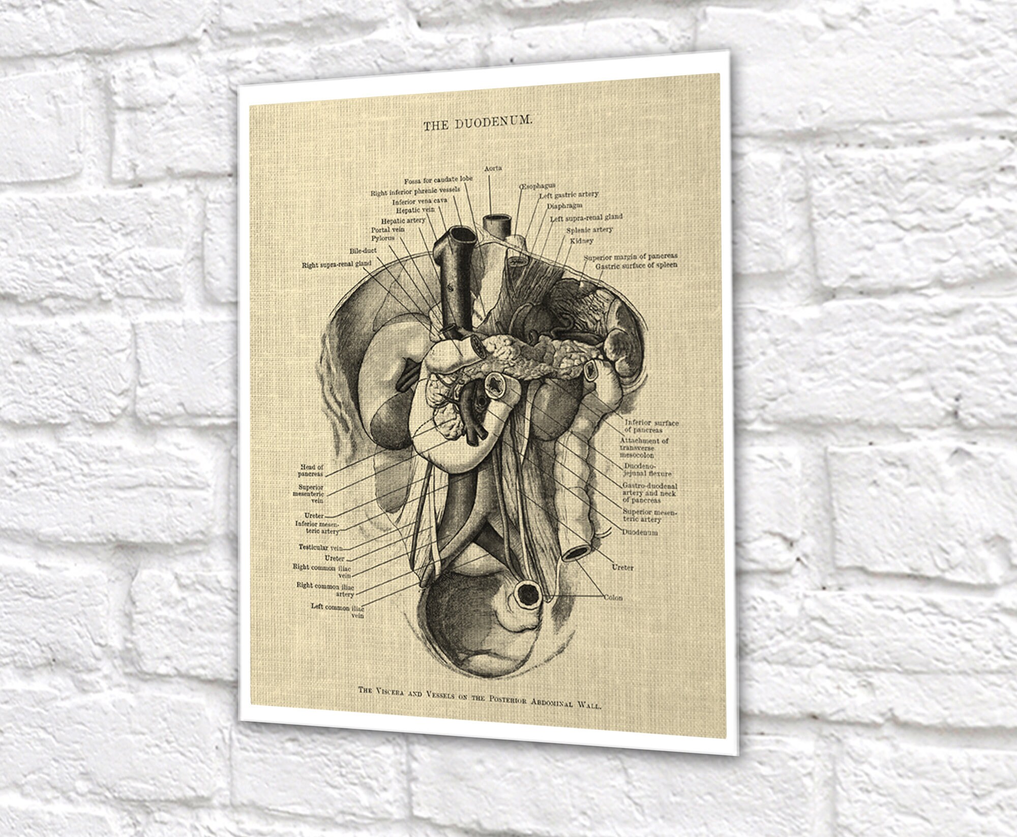 Gastrointestinal Anatomy Set of 3 Unframed Medical Decor Art Prints ...