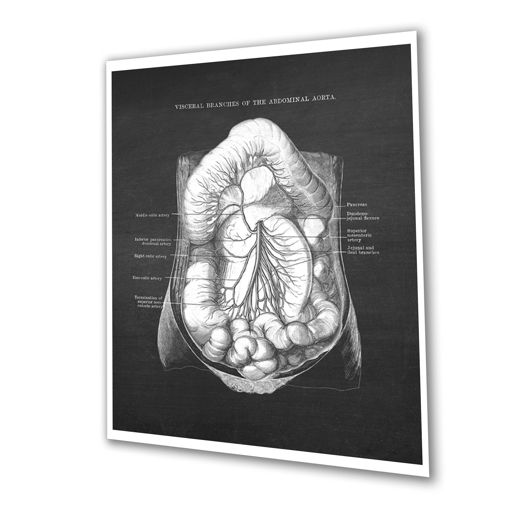Gastrointestinal Anatomy Set of 3 Unframed Medical Decor Art Prints ...