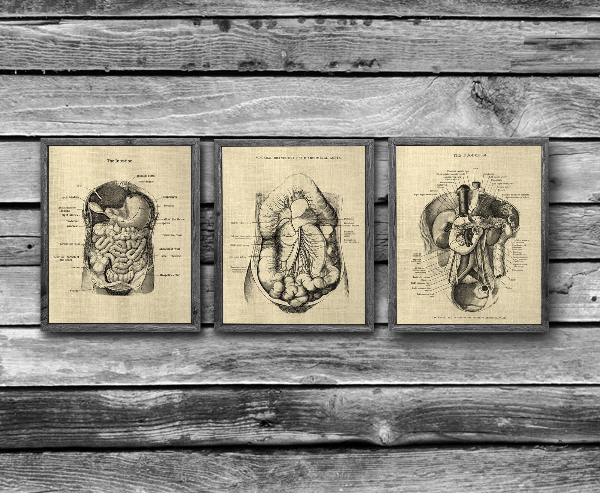 Gastrointestinal Anatomy Set of 3 Unframed Medical Decor Art Prints ...