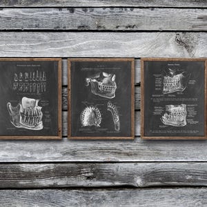 Puede incluir: Tres impresiones enmarcadas con ilustraciones anatómicas detalladas de dientes y mandíbulas. Las impresiones son de estilo vintage, con diagramas blancos sobre un fondo oscuro, enmarcadas en madera. El tema general es la anatomía dental.