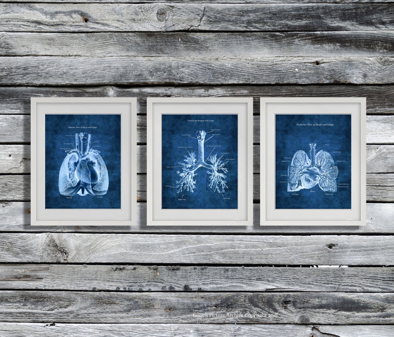 Anatomy of Lungs Heart Set of 3 Unframed Decor Art Prints Respiratory ...
