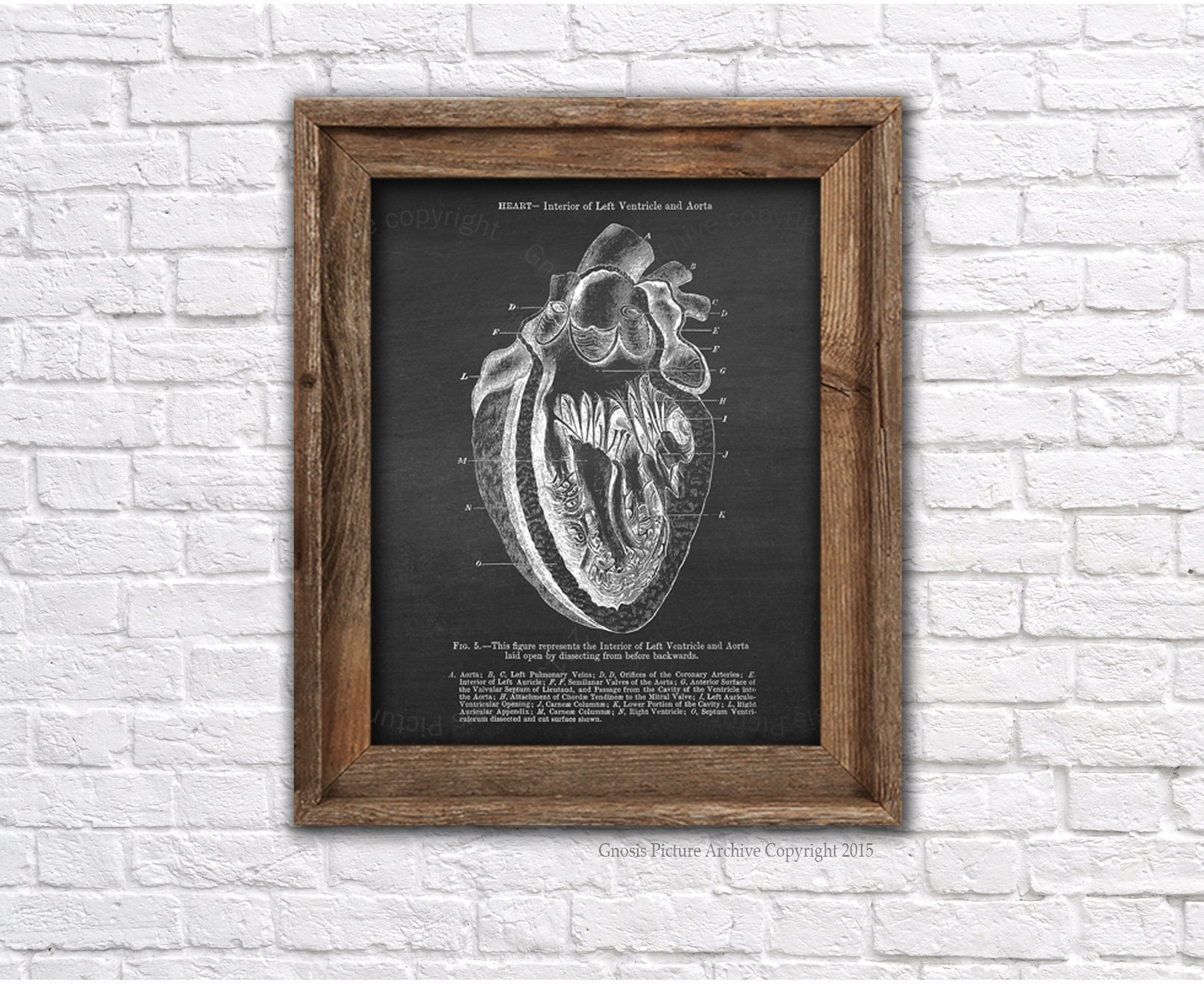 Anatomy Heart Art Prints Set of 3 Unframed Wall Art | Etsy