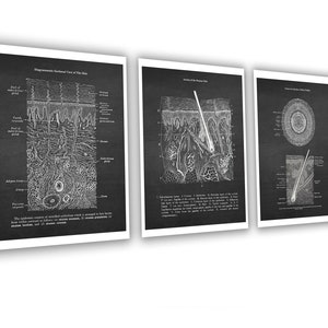 May include: Three black and white anatomical illustrations of human skin. The first image shows a cross-section of the skin with labels for the different layers. The second image shows a close-up of a hair follicle. The third image shows a cross-section of a hair follicle.