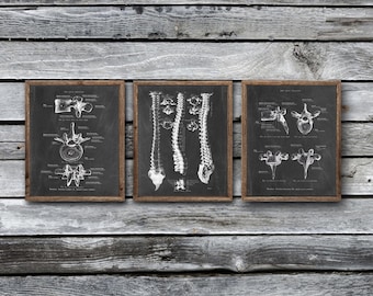 Könnte beinhalten: Drei gerahmte Drucke mit detaillierten anatomischen Illustrationen der menschlichen Wirbelsäule. Die Drucke sind im Tafelstil gehalten, mit weißen Diagrammen auf dunklem Hintergrund. Die Rahmen sind aus Holz, und die Gesamtästhetik ist vintage und lehrreich.