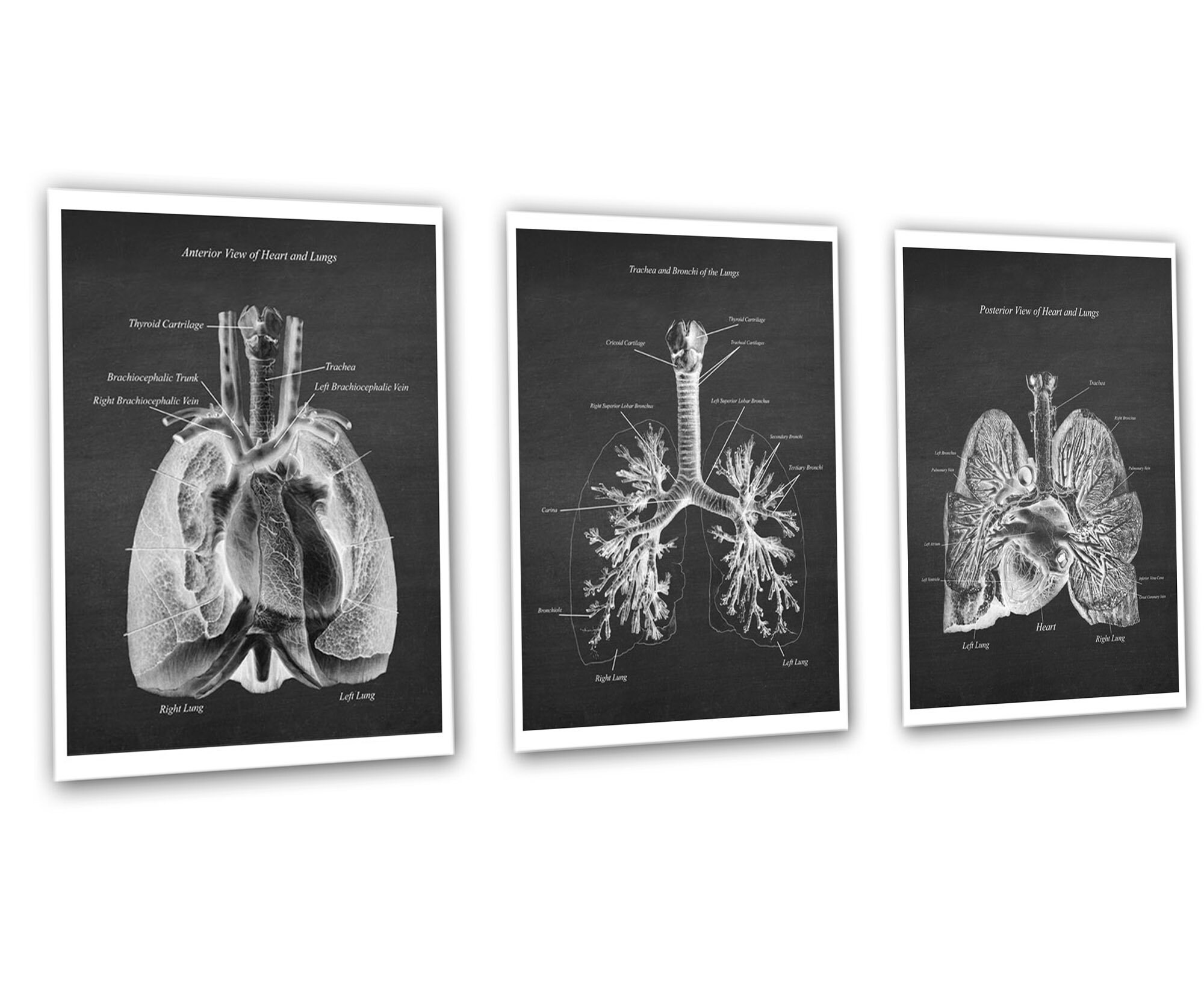 Anatomy of Lungs Heart Set of 3 Unframed Medical Decor Art Prints - Etsy