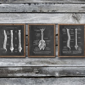 Backbone Spine Anatomy, set of 3 Unframed Art Prints - Orthopedic Decor - Chiropractic Decor - Physical Therapist Gift