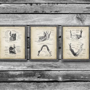 May include: Three framed vintage anatomical prints of the human jaw. Each print features detailed illustrations of the jawbone, with labeled diagrams in black ink on aged paper. The frames are a dark wood color, and the prints are displayed against a rustic wooden background.