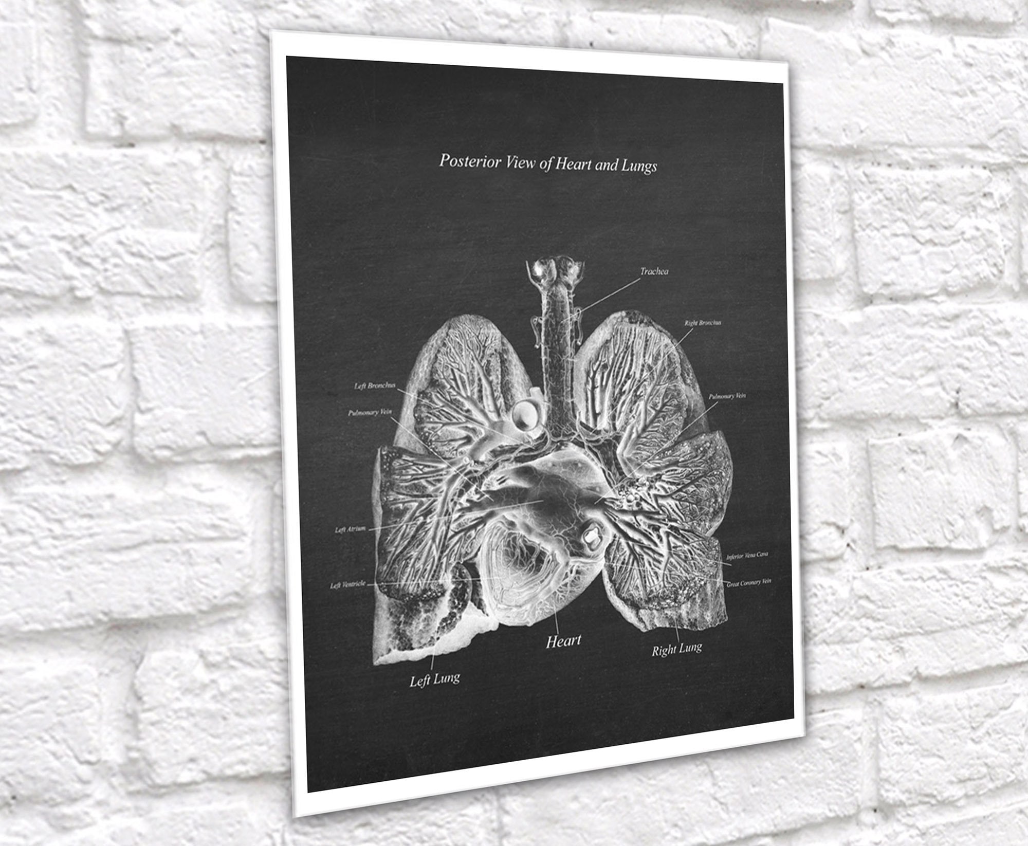 Anatomy of Lungs Heart Set of 3 Unframed Medical Decor Art Prints - Etsy
