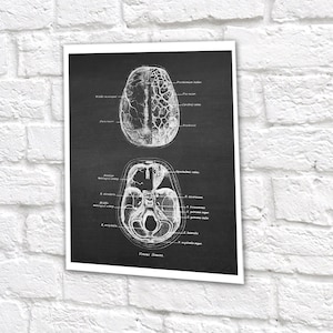 Neuroscience Anatomy of Human Brain set of 6 Unframed Decor Art Prints Gift for Neurosurgeon image 9