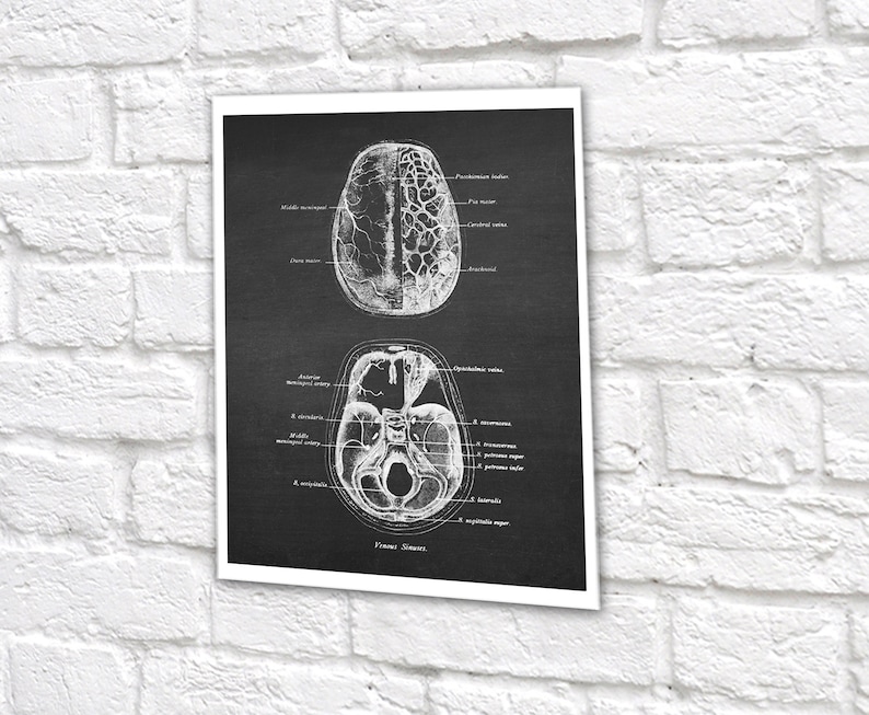 Neuroscience Anatomy of Human Brain set of 6 Unframed Decor Art Prints Gift for Neurosurgeon image 9