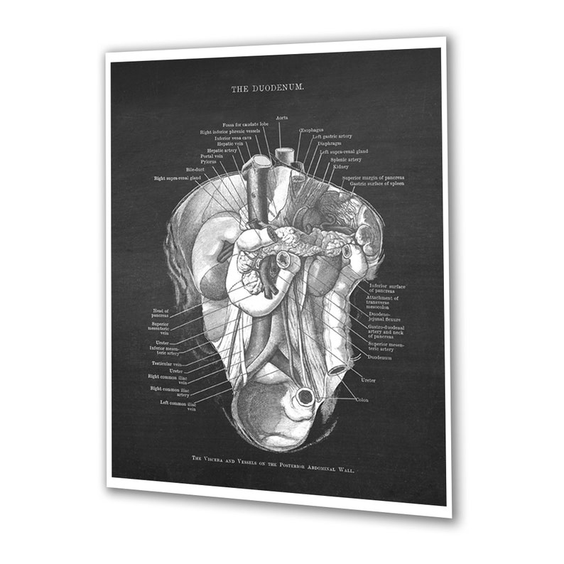 Gastrointestinal Anatomy Set of 3 Unframed Medical Decor Art Prints ...