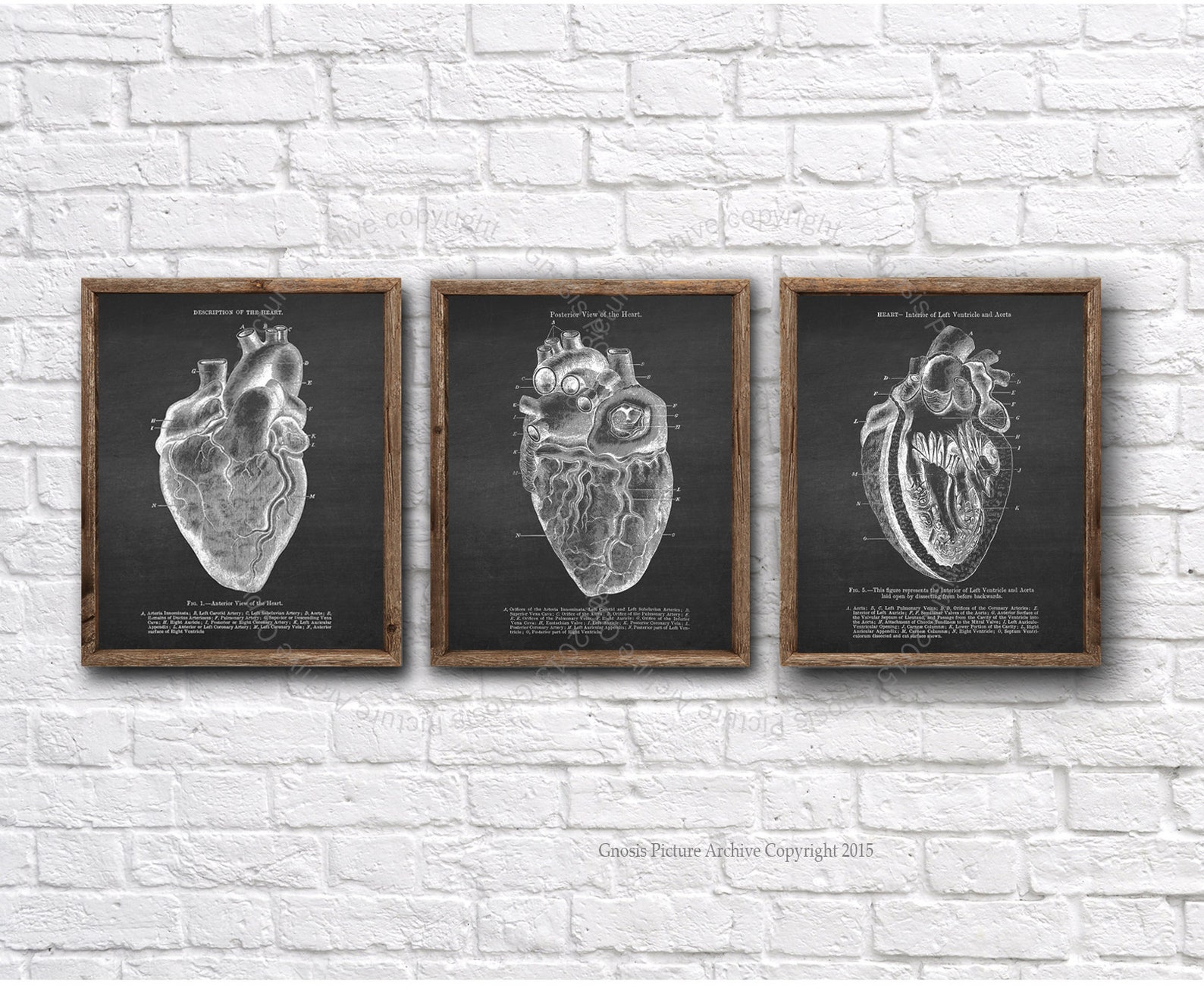 Anatomy Heart Art Prints Set of 3 Unframed Wall Art - Etsy
