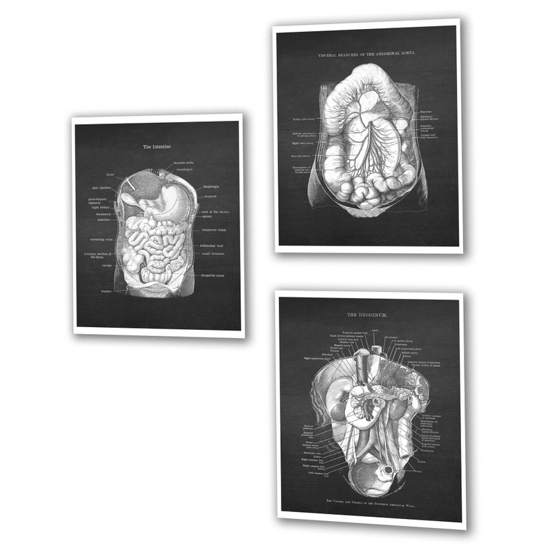 Gastrointestinal Anatomy Set of 3 Unframed Medical Decor Art Prints ...