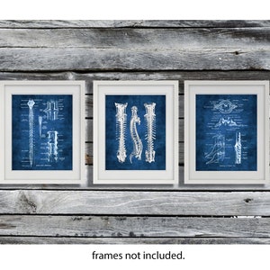 Chiropractor Gift, Physical Therapist Gift, Spinal Cord Anatomy, Blue Anatomy Art Therapy Waiting Room Decor Doctor of Chiropractic Gift