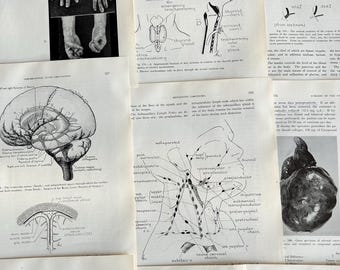 antique Surgery textbook illustrations, antique medical anatomy oddities book pages for paper crafting