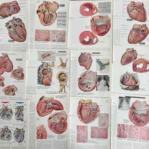 May include: A collection of vintage anatomical illustrations of the human heart. The illustrations are in colour and show different views of the heart, including the chambers, valves, and blood vessels. The illustrations are printed on paper and have a vintage look.